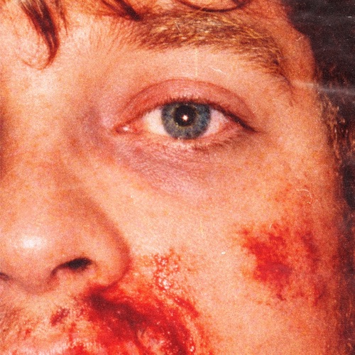 DISSY - morgen werde ich mich dafür hassen (side b) (2026)